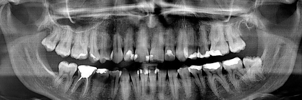 shutterstock_149422055