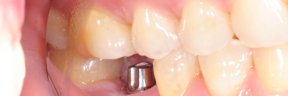 shutterstock_112057412