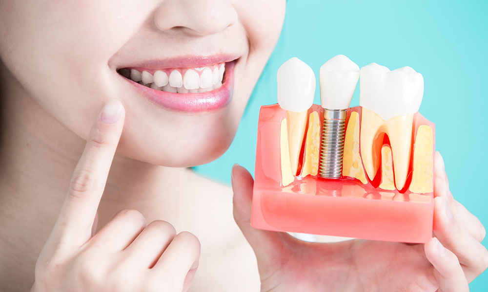 Dental Implant Treatment Costs in Istanbul / Turkey